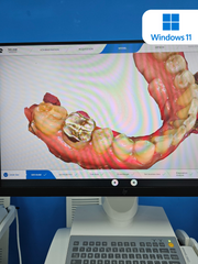 Win 11 - OmniBeast® - Omnicam Upgrade + 24" Touch Monitor - $5,250.00