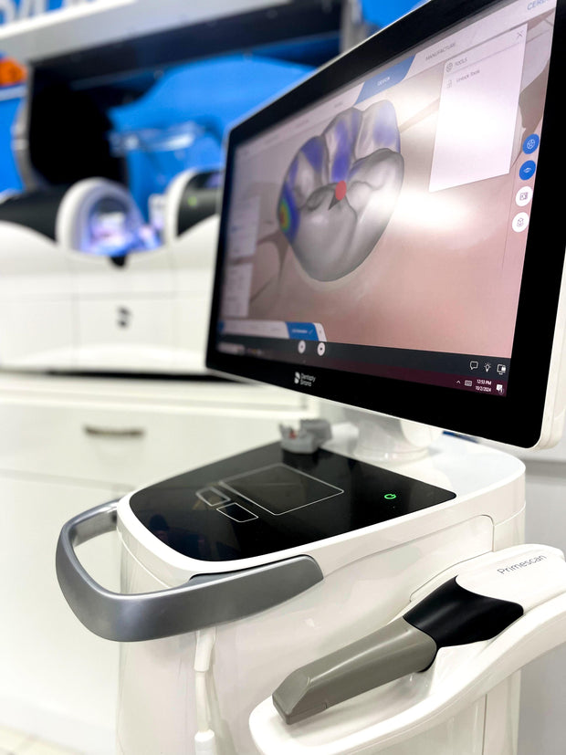 CEREC Primescan + MCXL Mill (Wet/Dry) + SpeedFire - $79,900.00