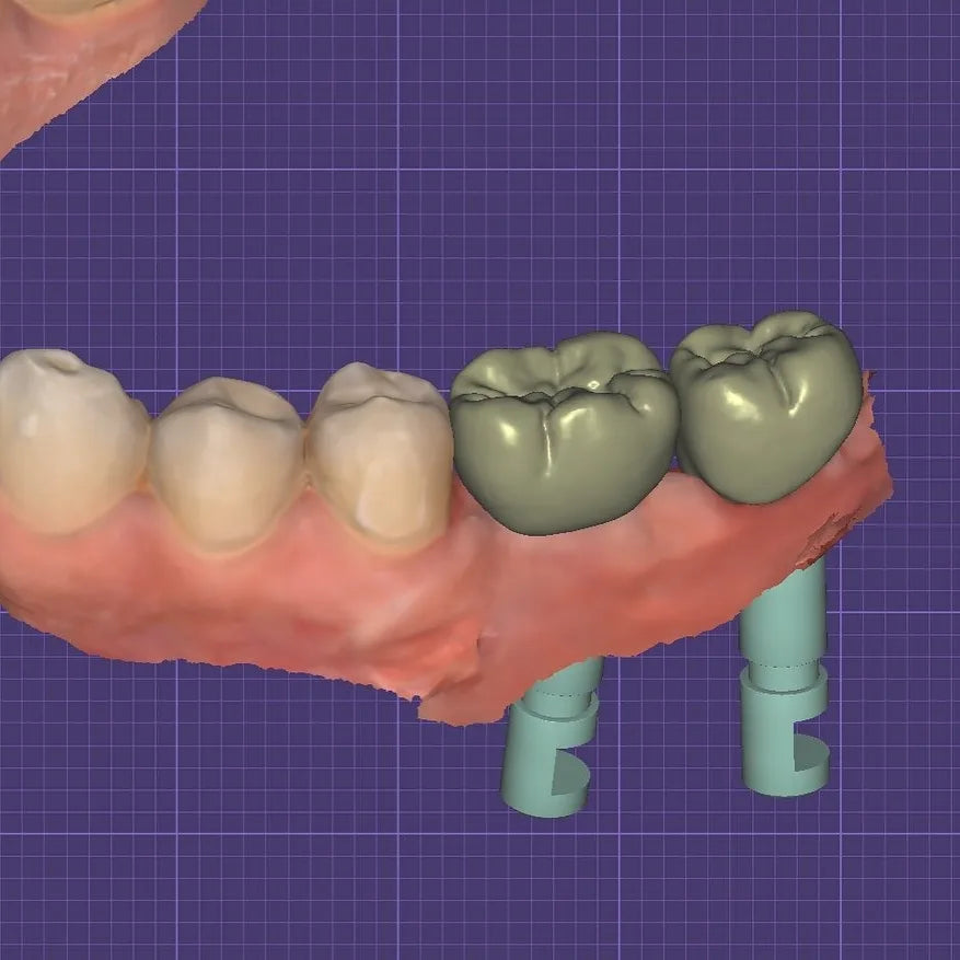 Shining 3D AoralScan 3 Wireless + CEREC® MCXL Milling Unit +