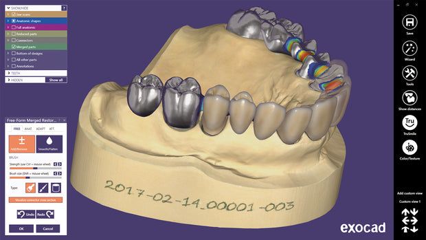 Exocad DentalCAD Matera 2.3