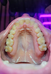 iMirror - Dental Fog Free Photo Mirror - LED Lights - Rechargable