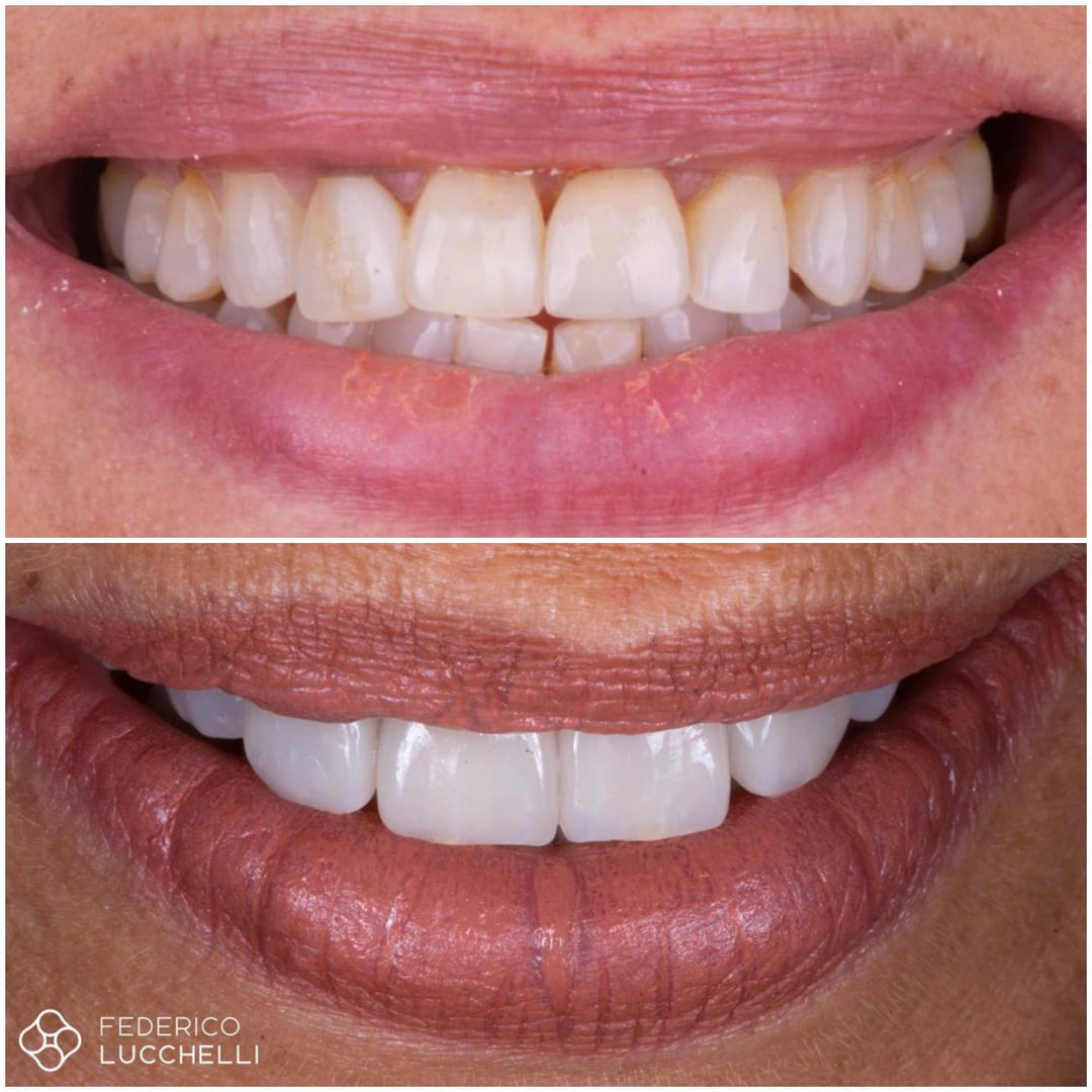 CEREC Master Kit - Stain and Glaze + Finishing Kit - $2,757.00